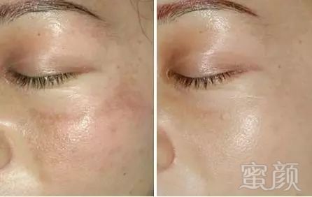 https://img.miyanlife.com/mnt/timg/180611/12160B553-2.jpg