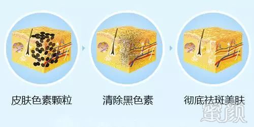 https://img.miyanlife.com/mnt/timg/180611/12160CS1-3.jpg