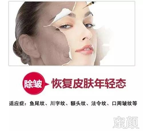 https://img.miyanlife.com/mnt/timg/180612/105ACH6-2.jpg