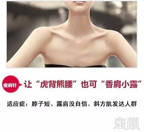 https://img.miyanlife.com/mnt/timg/180612/105AMF7-5.jpg