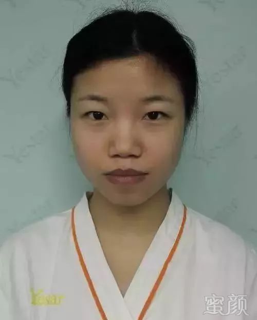 https://img.miyanlife.com/mnt/timg/180612/1105036209-2.jpg