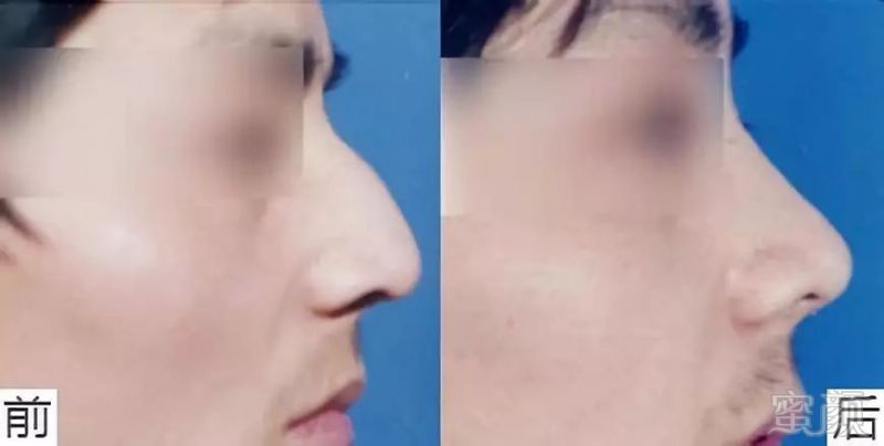 案例图片