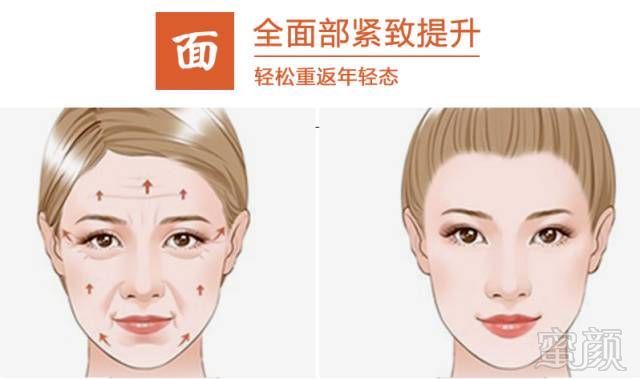 https://img.miyanlife.com/mnt/timg/180612/1109514V2-10.jpg