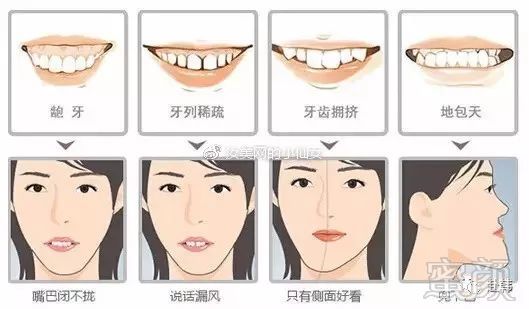 https://img.miyanlife.com/mnt/timg/180612/110JA2U-10.jpg