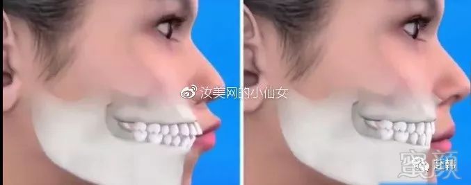 https://img.miyanlife.com/mnt/timg/180612/110JAc2-12.jpg
