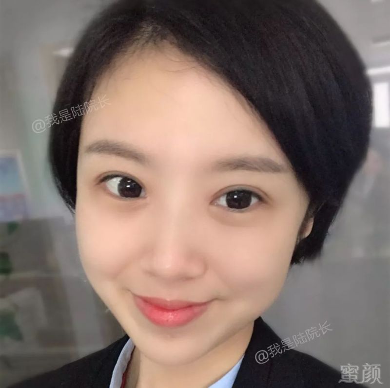 https://img.miyanlife.com/mnt/timg/180612/110R563U-1.jpg