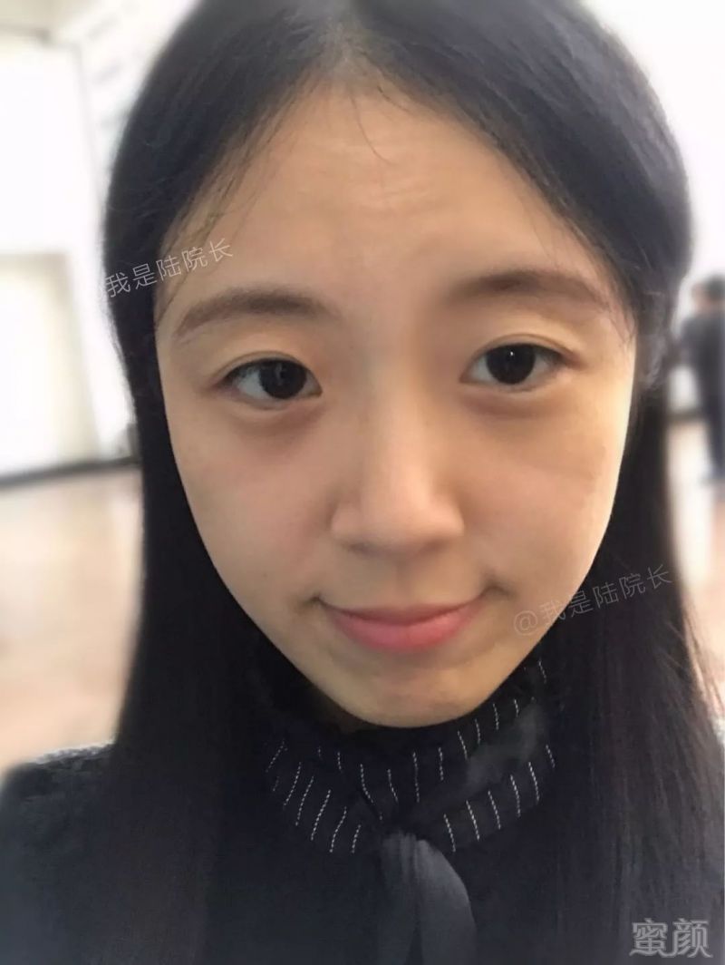 https://img.miyanlife.com/mnt/timg/180612/110RI552-9.jpg