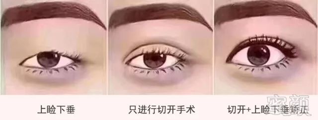 https://img.miyanlife.com/mnt/timg/180612/110RV229-12.jpg