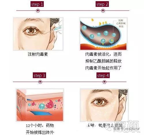 https://img.miyanlife.com/mnt/timg/180613/10562T910-1.jpg