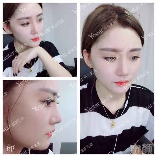 案例图片