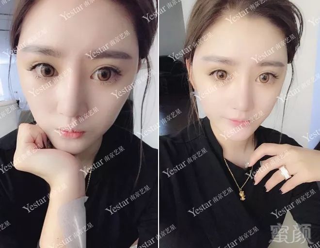 案例图片
