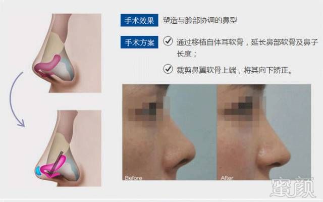 https://img.miyanlife.com/mnt/timg/180613/11360010J-6.jpg
