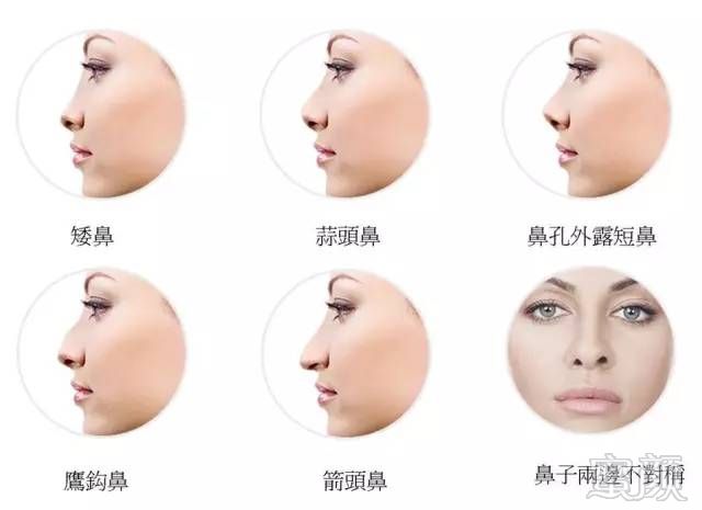 https://img.miyanlife.com/mnt/timg/180613/1136004W2-2.jpg