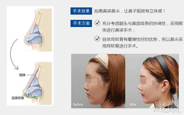 https://img.miyanlife.com/mnt/timg/180613/113600FV-3.jpg