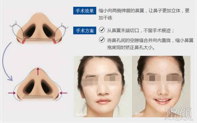 https://img.miyanlife.com/mnt/timg/180613/113600N58-5.jpg