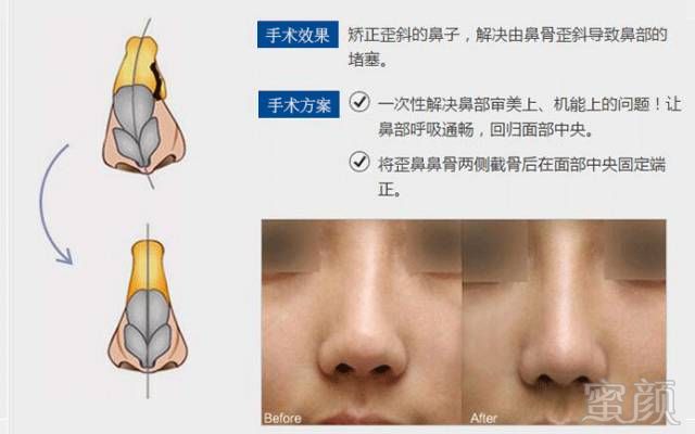 https://img.miyanlife.com/mnt/timg/180613/1136015540-8.jpg