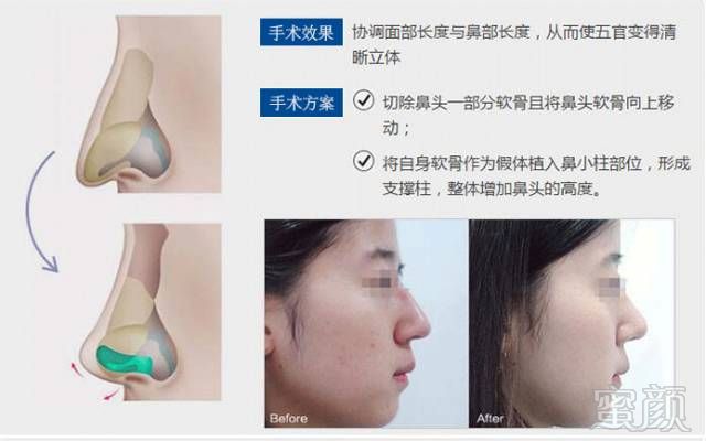 https://img.miyanlife.com/mnt/timg/180613/11360155U-10.jpg