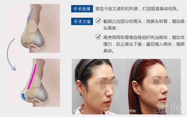 https://img.miyanlife.com/mnt/timg/180613/113601MV-7.jpg