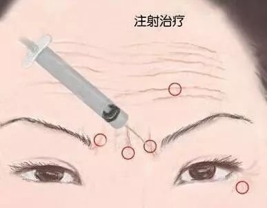 https://img.miyanlife.com/mnt/timg/180613/11462135C-9.jpg