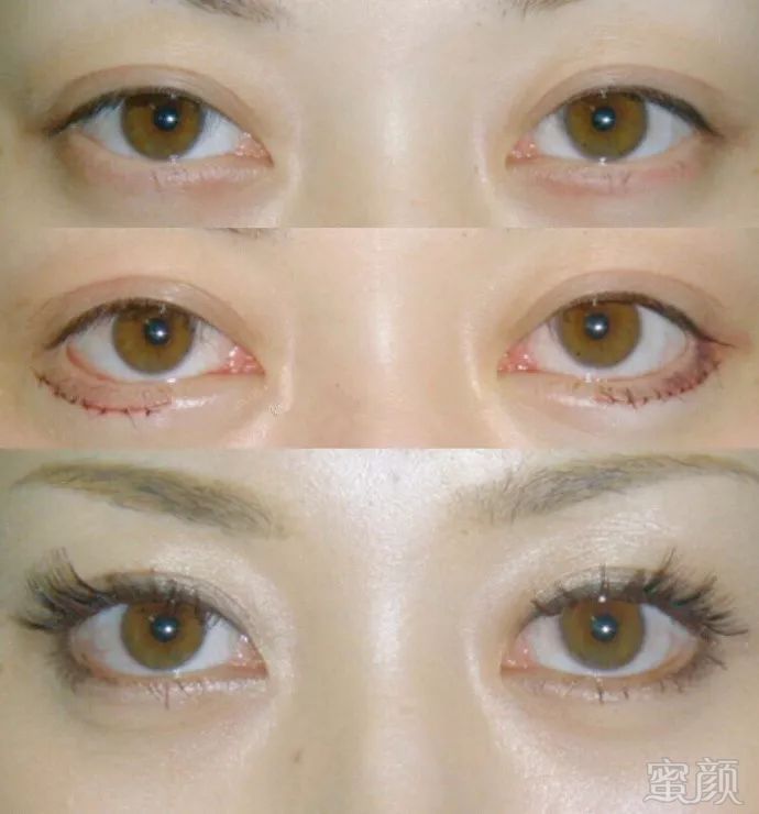 https://img.miyanlife.com/mnt/timg/180613/1209522231-0.jpg