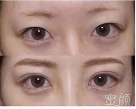 https://img.miyanlife.com/mnt/timg/180613/12095314T-1.jpg