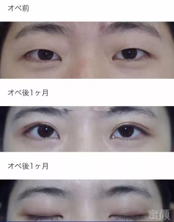 https://img.miyanlife.com/mnt/timg/180613/120953H39-2.jpg