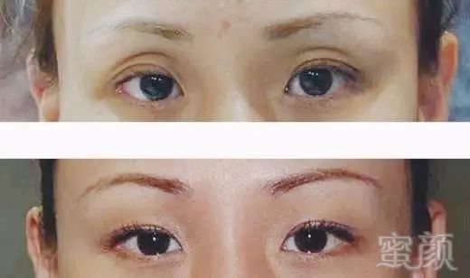 https://img.miyanlife.com/mnt/timg/180613/1209545G1-5.jpg