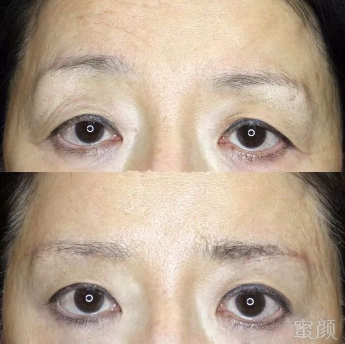 https://img.miyanlife.com/mnt/timg/180613/1209551a2-8.jpg
