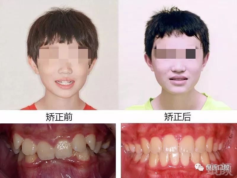 https://img.miyanlife.com/mnt/timg/180613/120KLK4-6.jpg