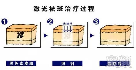 案例图片