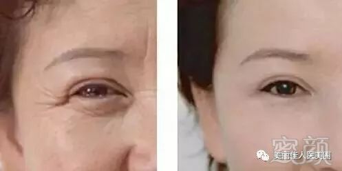 https://img.miyanlife.com/mnt/timg/180614/11334L316-0.jpg