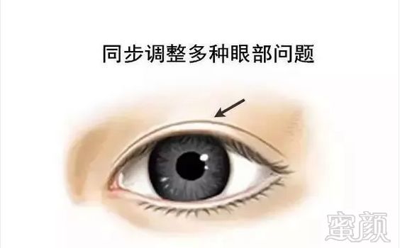 https://img.miyanlife.com/mnt/timg/180615/1115521T3-8.jpg
