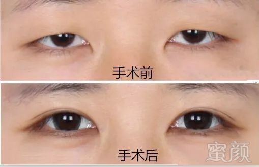 https://img.miyanlife.com/mnt/timg/180615/1115524641-6.jpg