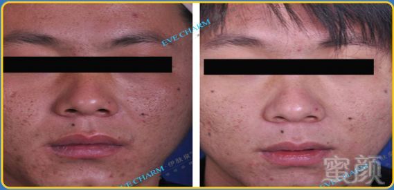 https://img.miyanlife.com/mnt/timg/180615/114631M10-3.jpg