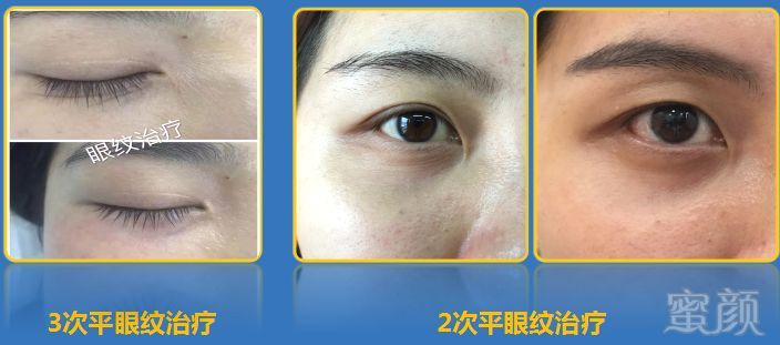 https://img.miyanlife.com/mnt/timg/180615/1146324006-8.jpg