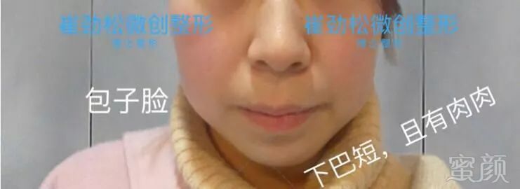 https://img.miyanlife.com/mnt/timg/180615/120212KB-1.jpg