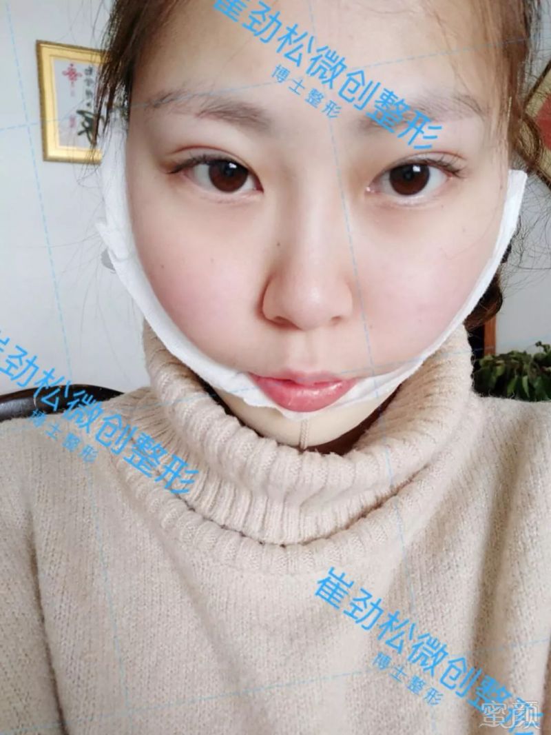 https://img.miyanlife.com/mnt/timg/180615/1202132091-5.jpg