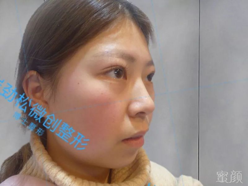 https://img.miyanlife.com/mnt/timg/180615/1202134Z6-4.jpg