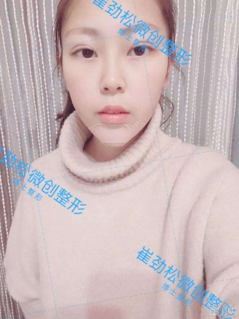 https://img.miyanlife.com/mnt/timg/180615/120214H19-7.jpg