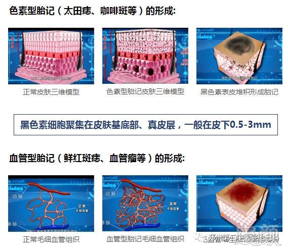 案例图片