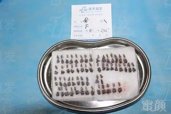 https://img.miyanlife.com/mnt/timg/180616/12012L1J-5.jpg