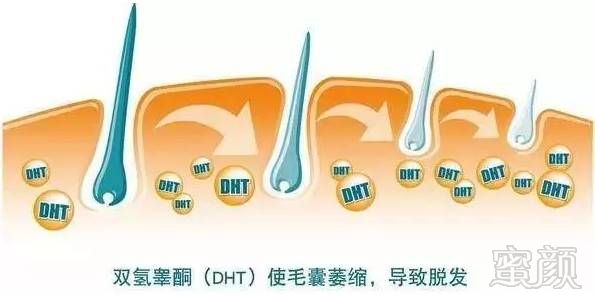 https://img.miyanlife.com/mnt/timg/180617/1209151052-2.jpg