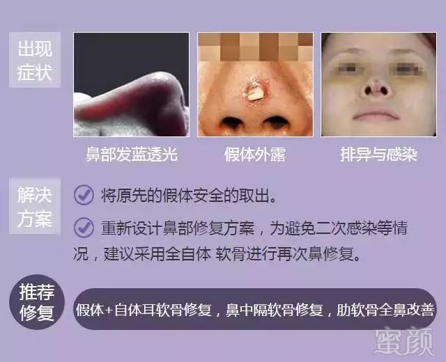 https://img.miyanlife.com/mnt/timg/180617/124104G07-6.jpg