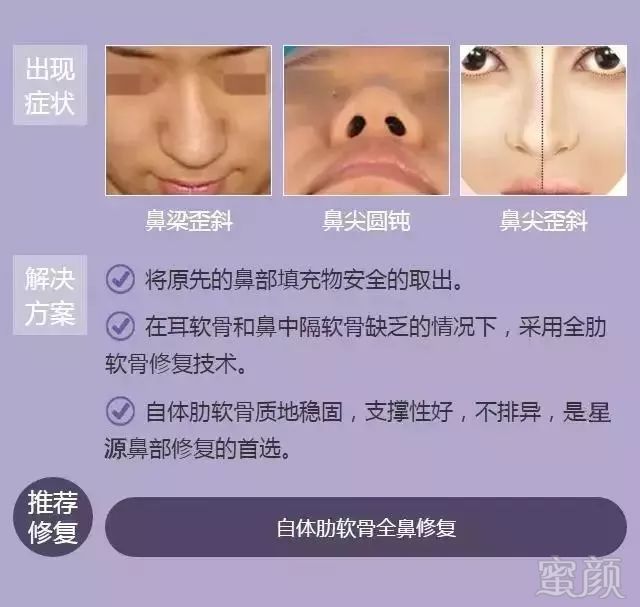 https://img.miyanlife.com/mnt/timg/180617/1241052154-8.jpg