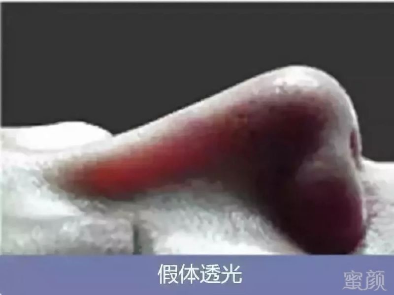 https://img.miyanlife.com/mnt/timg/180617/12410G1H-15.jpg