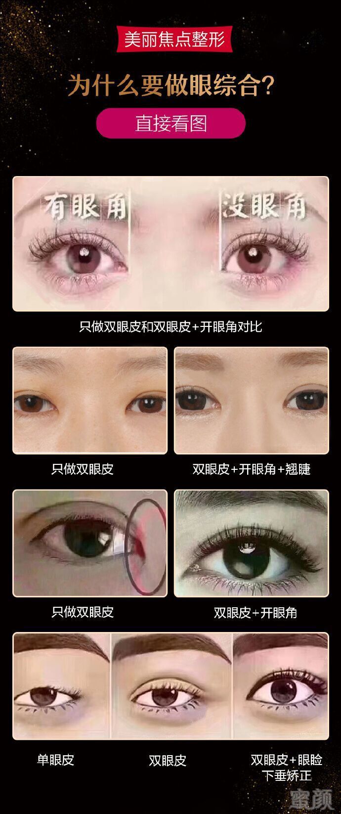 https://img.miyanlife.com/mnt/timg/180617/1300062435-8.jpg