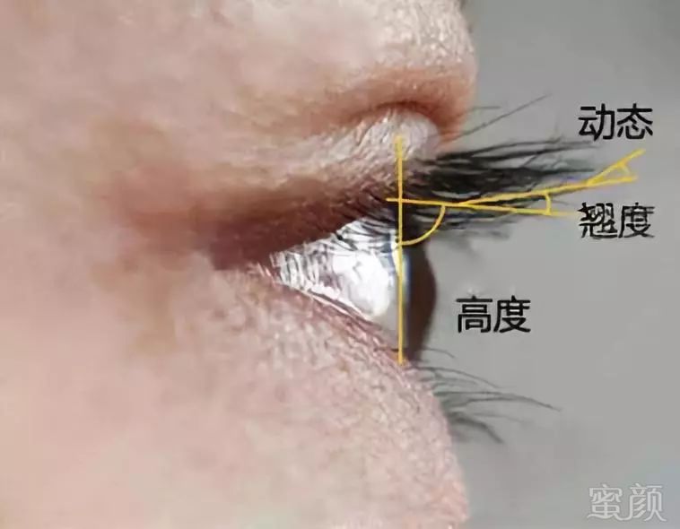 https://img.miyanlife.com/mnt/timg/180617/1300096403-10.jpg