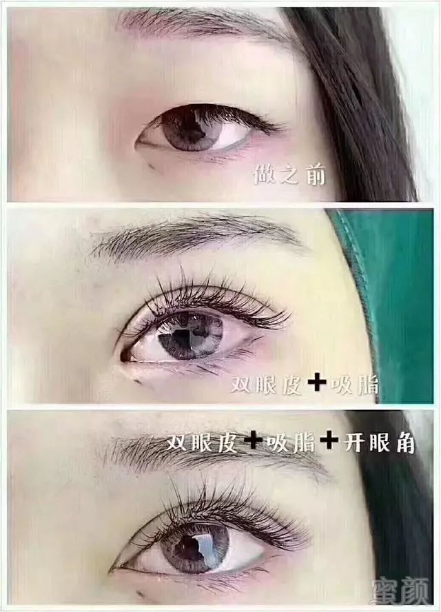 https://img.miyanlife.com/mnt/timg/180617/13000V060-9.jpg