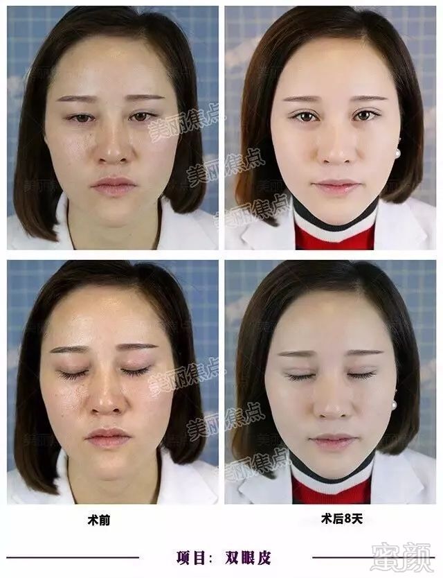 https://img.miyanlife.com/mnt/timg/180617/13000aW8-12.jpg