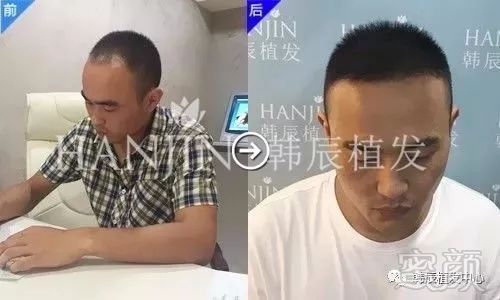 案例图片